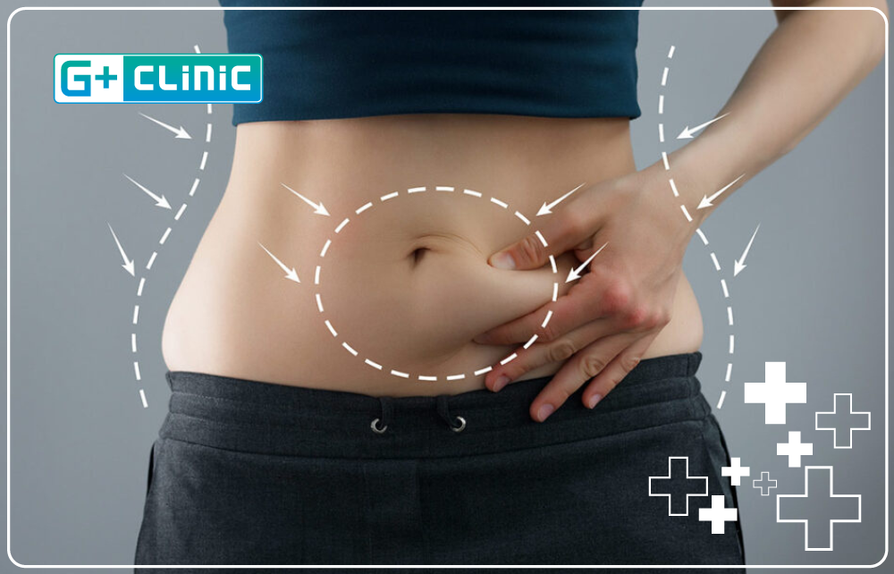 tummy tuck logo