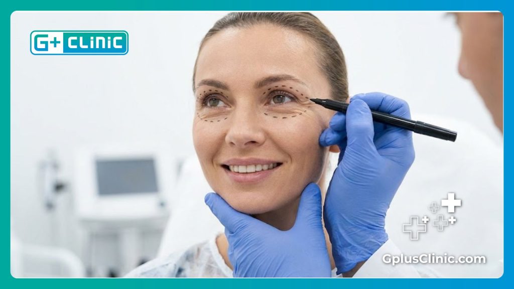 Résultat parfait d'une chirurgie des paupières réussie.