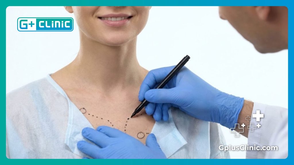 Хирург наносит разметку перед операцией по восстановлению груди.