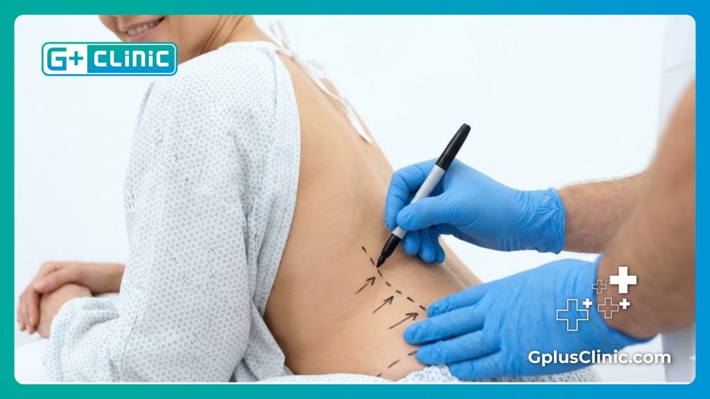 Marquage préopératoire pour la chirurgie des fesses.