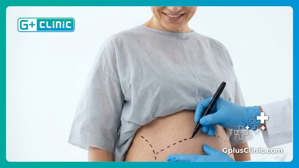 Close-up of a doctor making precise surgical markings on a patient's abdomen for optimal results.