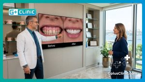 Cosmetic gum surgery in Turkey | 3 Facts