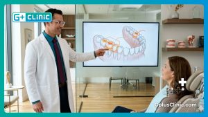 Features of Dental Fillings in Turkey | 5 Facts