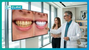Laser Teeth Whitening in Turkey | 7 Facts