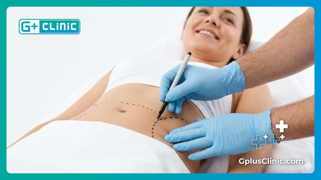 Идеальный результат плоского живота после операции