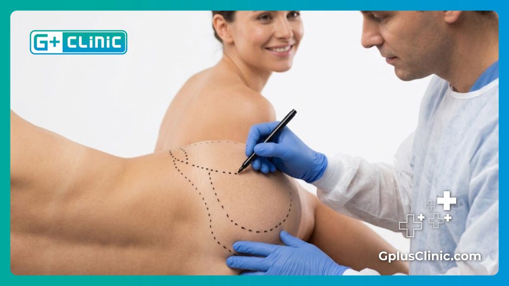 Marcado preoperatorio preciso realizado por el cirujano