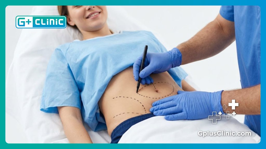 Пластический хирург наносит точную медицинскую разметку на живот пациента.