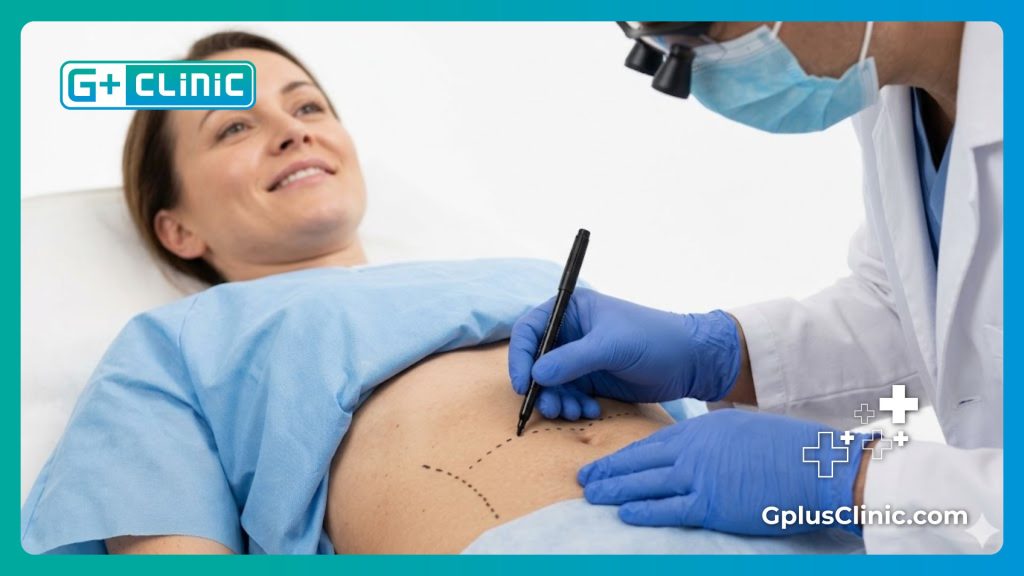 Tracé chirurgical précis sur l'abdomen pour une procédure esthétique réussie.