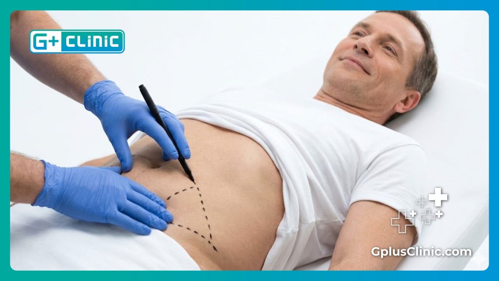 Preparación experta para el procedimiento quirúrgico de varicocele