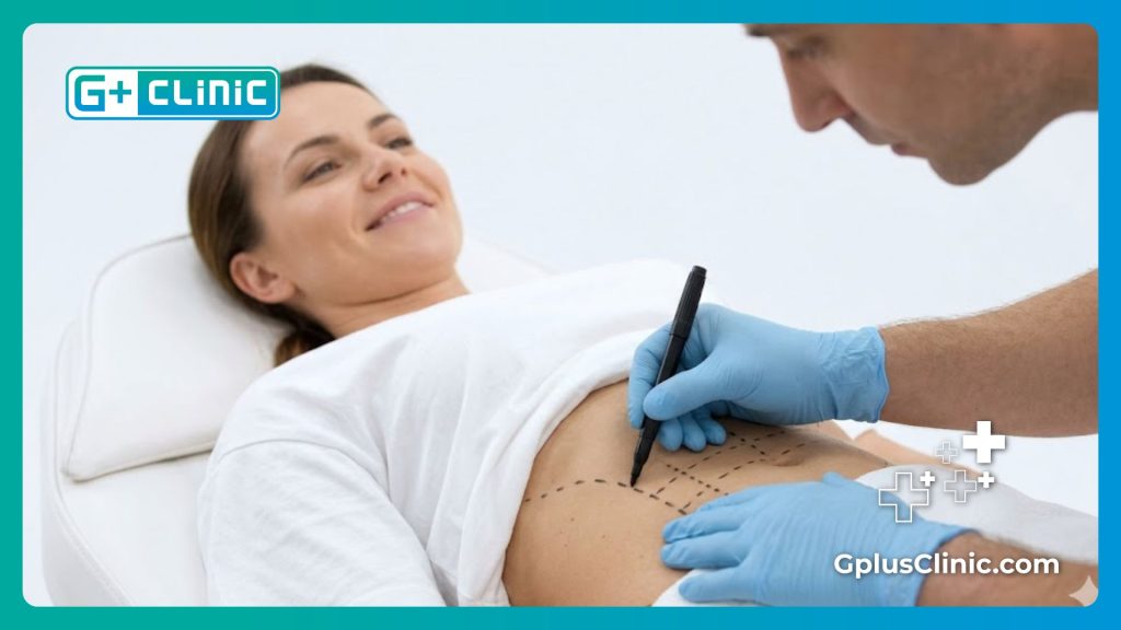 جراح تجميل يرسم خطوط التخطيط الجراحي بدقة على منطقة بطن المريض قبل بدء العملية
