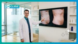 J-Plasma Body Contouring in Turkey | 3 Tips