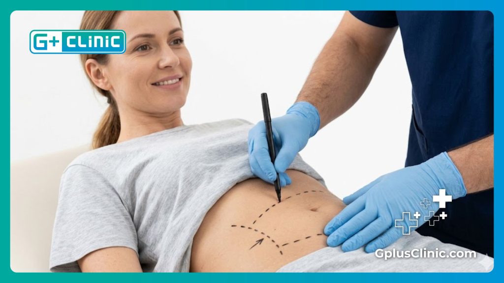 طبيب تجميل يرسم خطوط التخطيط الجراحي على منطقة البطن للمريض بدقة متناهية قبل البدء.