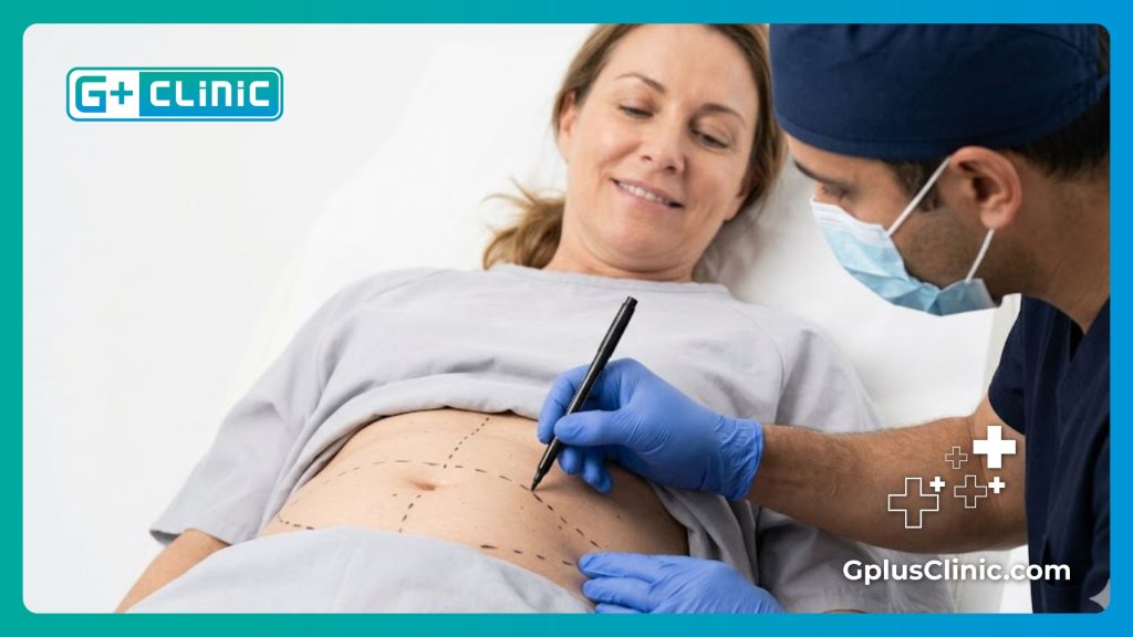 Surgeon marking the abdomen for precise and safe body sculpting
