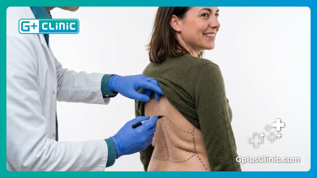Marcas quirúrgicas precisas en la espalda del paciente para asegurar un resultado estético perfecto.