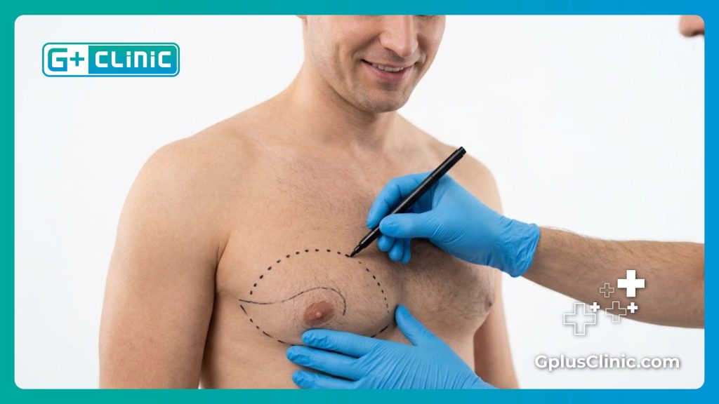 Resultado impecable de la reducción pectoral masculina