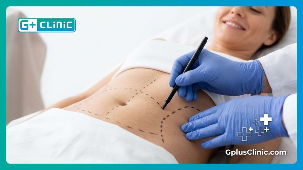 طبيب تجميل يرسم خطوط جراحية دقيقة على بطن مريضة استعداداً لشد الترهلات